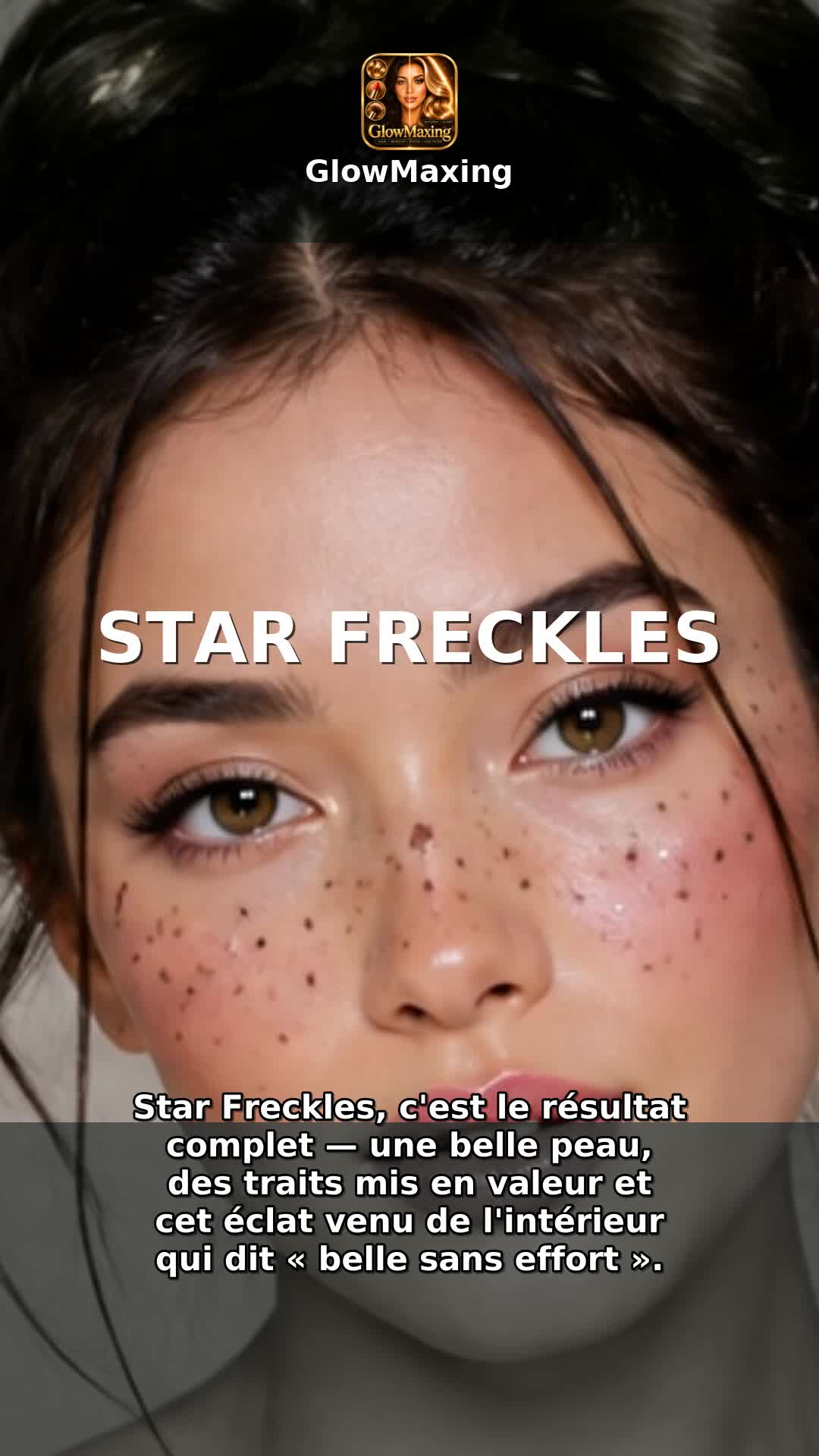 Star Freckles