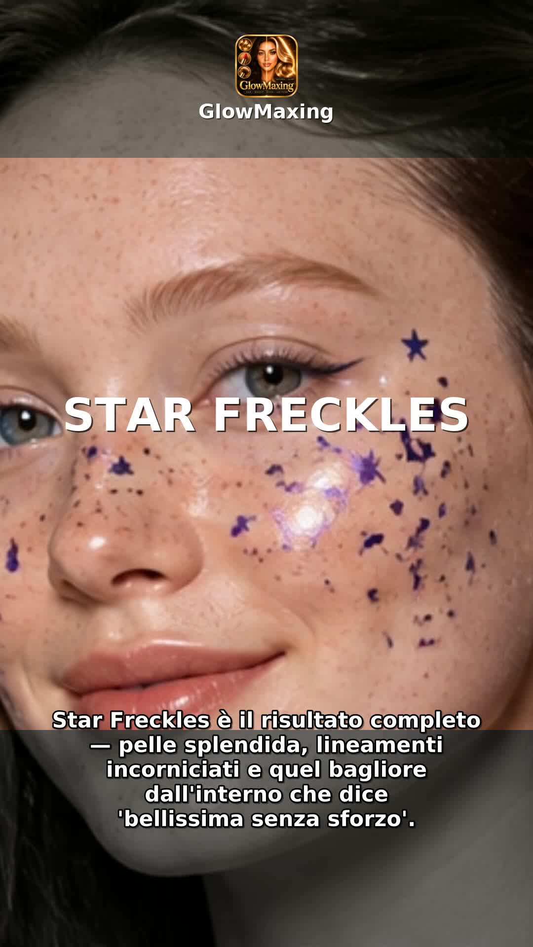 Star Freckles