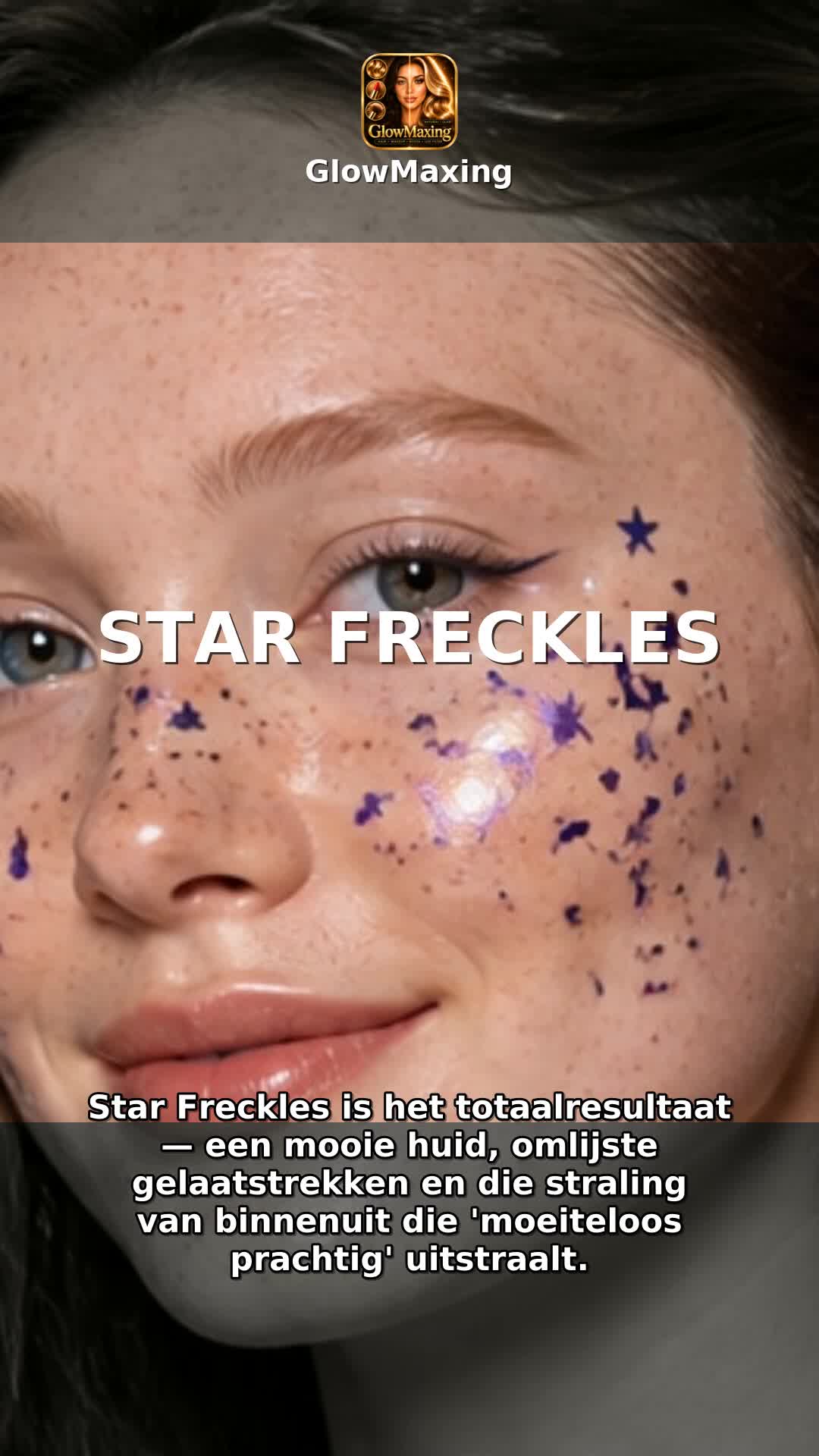 Star Freckles