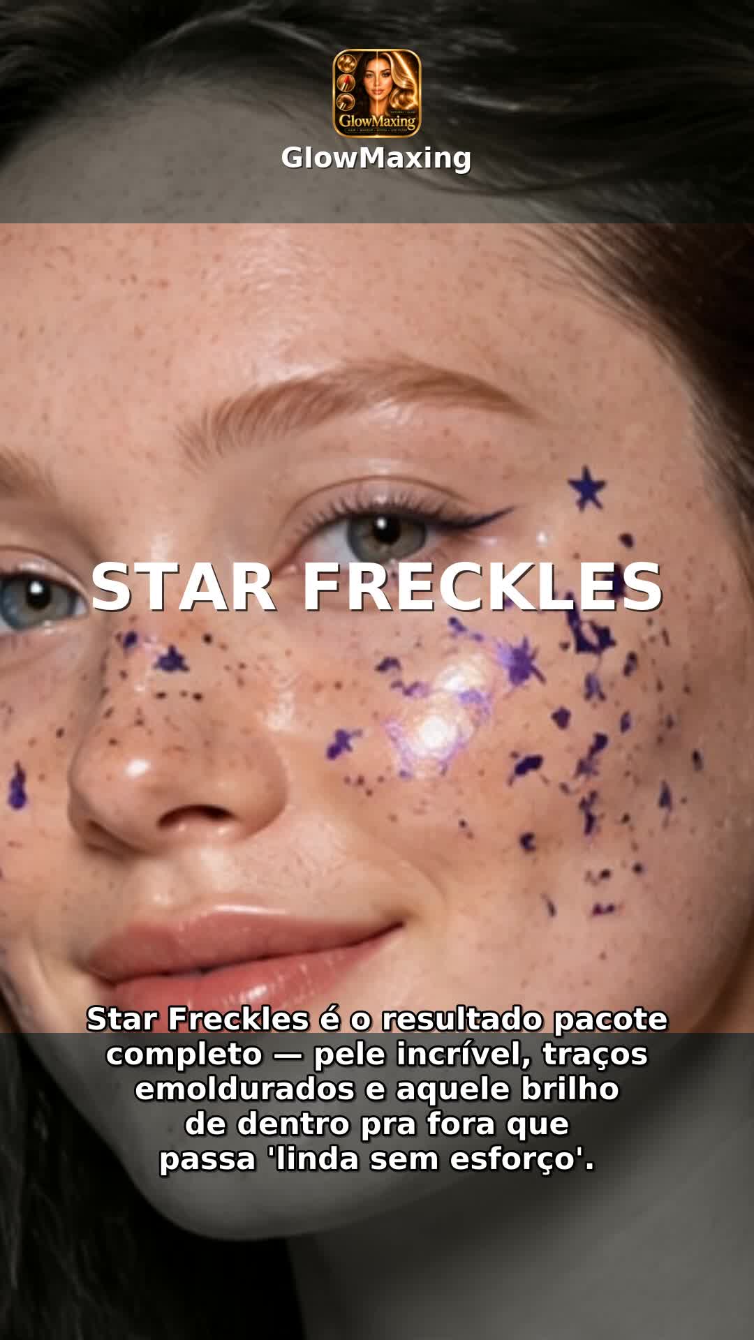 Star Freckles